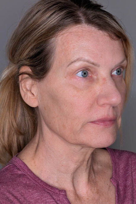 UltraClear case #5240