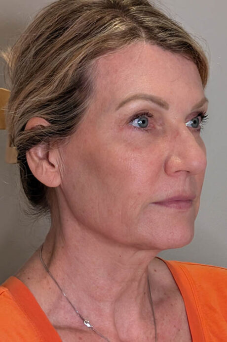 UltraClear case #5240