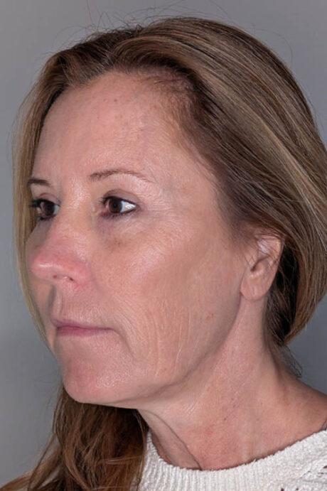 UltraClear case #5633