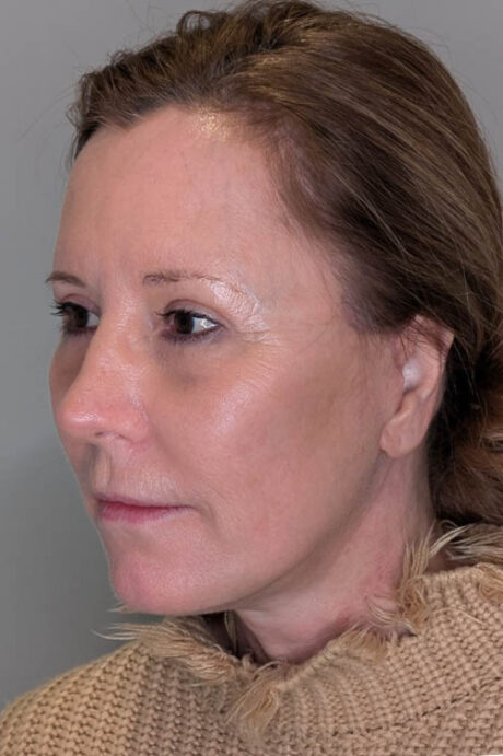 UltraClear case #5633