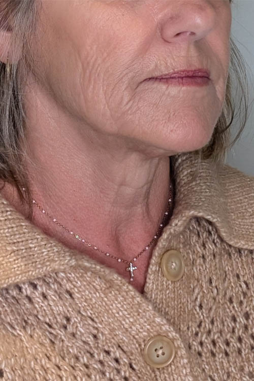 UltraClear case #5636