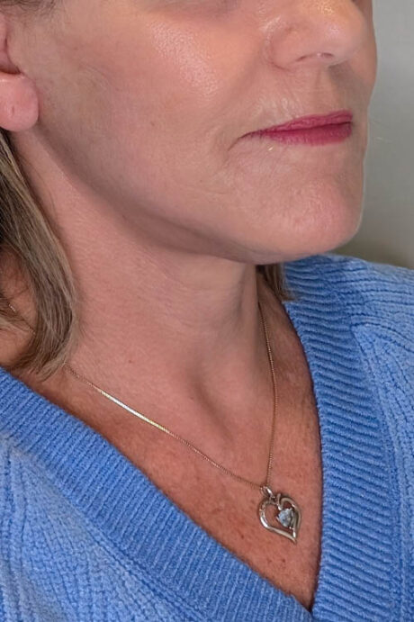 UltraClear case #5636