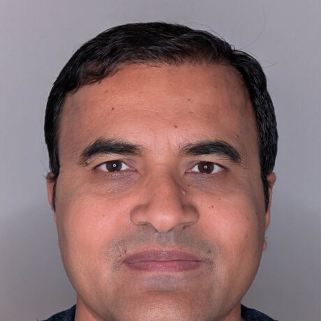 Hair Transplant case #6183